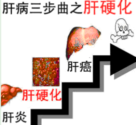 乙男科毒变异耐药有什么表现？